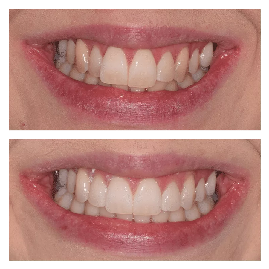 Bank House Dental | Comparison
