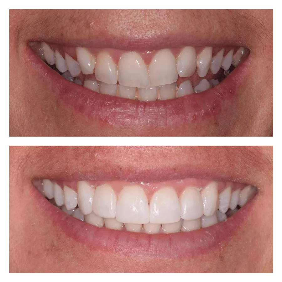 Bank House Dental | Comparison