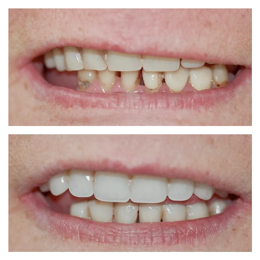 Bank House Dental | Comparison
