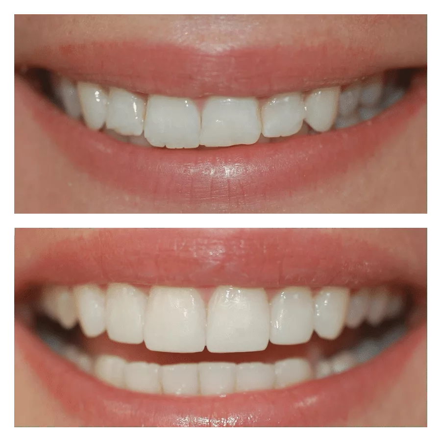 Bank House Dental | Comparison